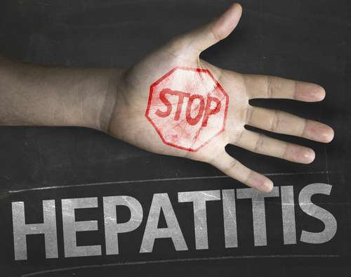 Ilustrasi hepatitis. (Shutterstocks)