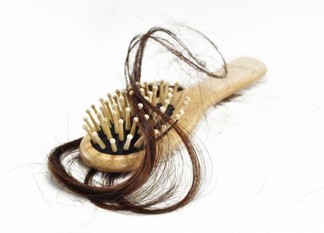 Ilustrasi rambut rontok. (Sumber: Shutterstock)