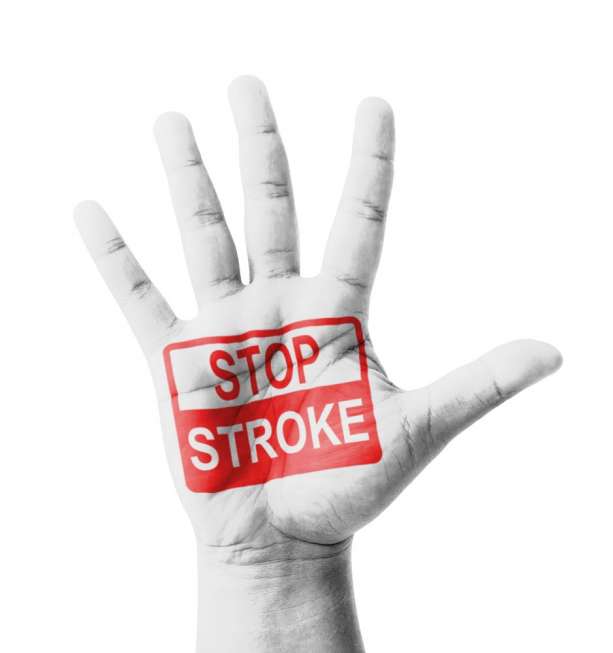 Ilustrasi penyakit stroke. (Shutterstock)