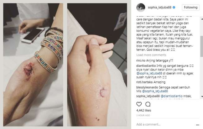 Cuma 2 Hari, Luka Digigit Anjing Sophia Latjuba Sembuh - 1