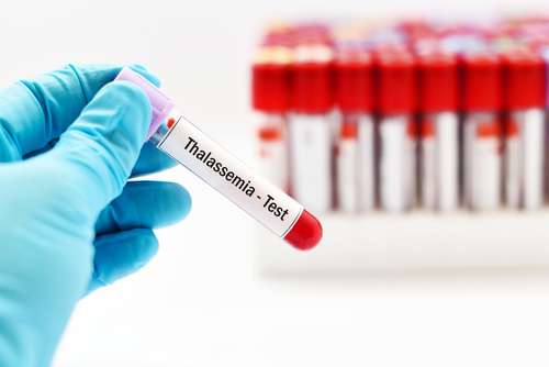 Ilustrasi sampel darah dalam tes Thalassemia. [Shutterstock]