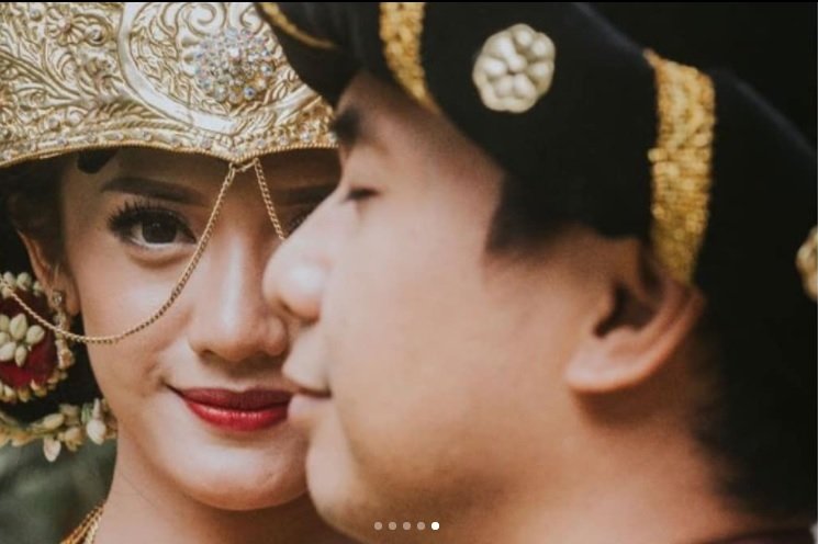 Salah satu foto pre-wedding Raditya Dika dan Anissa Aziza. (Instagram)