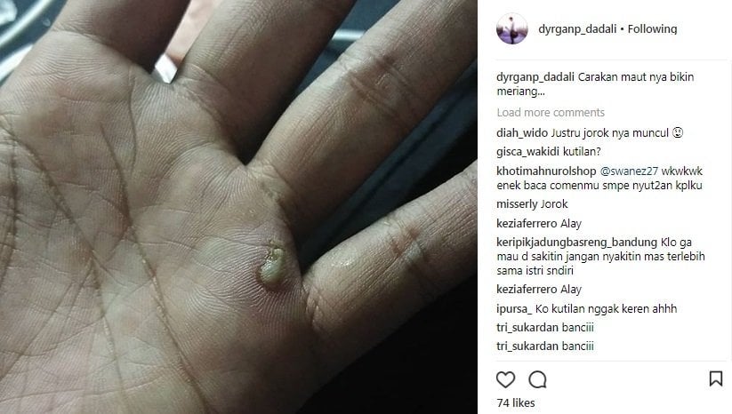 Postingan Dyrga Dadali. [Instagram]