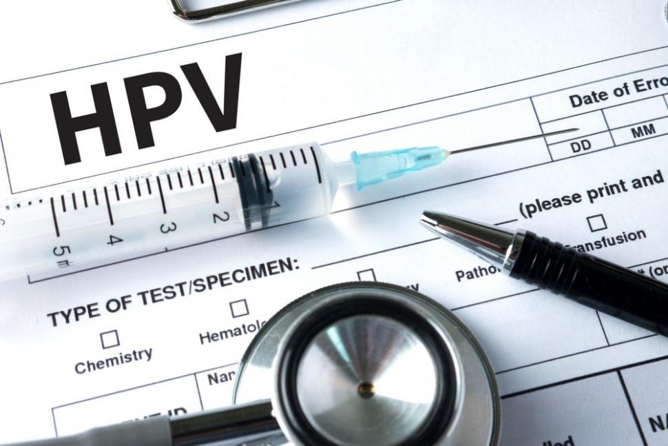 HPV meningkatkan risiko esofagus. (Shutterstock)