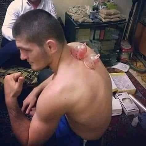 Beredar foto Khabib saat di Bekam [Foto Whatsapp]