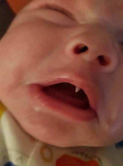 Bayi 11 minggu yang punya gigi taring seperti vampir [facebook @Tara O'Byrne]