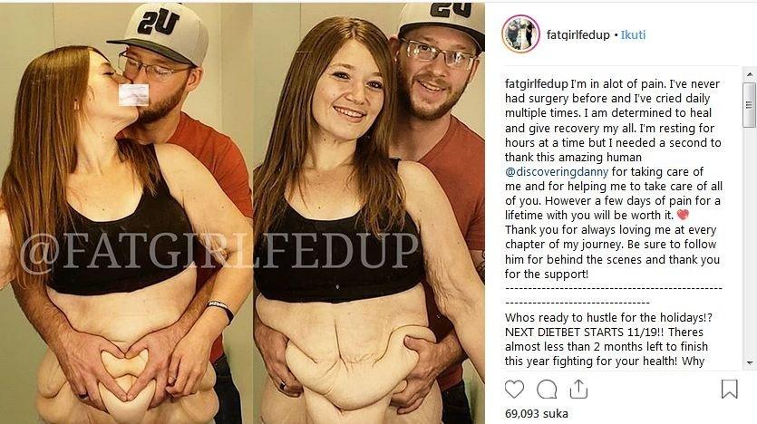 Lexi, perempuan yang berhasil turunkan berat badan hingga 120 kg (IG @fatgirlfedup)