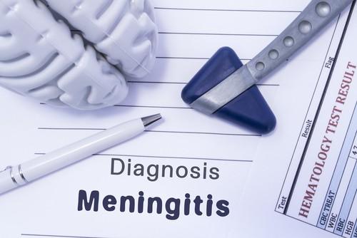 Ilustrasi meningitis. (Shutterstock)