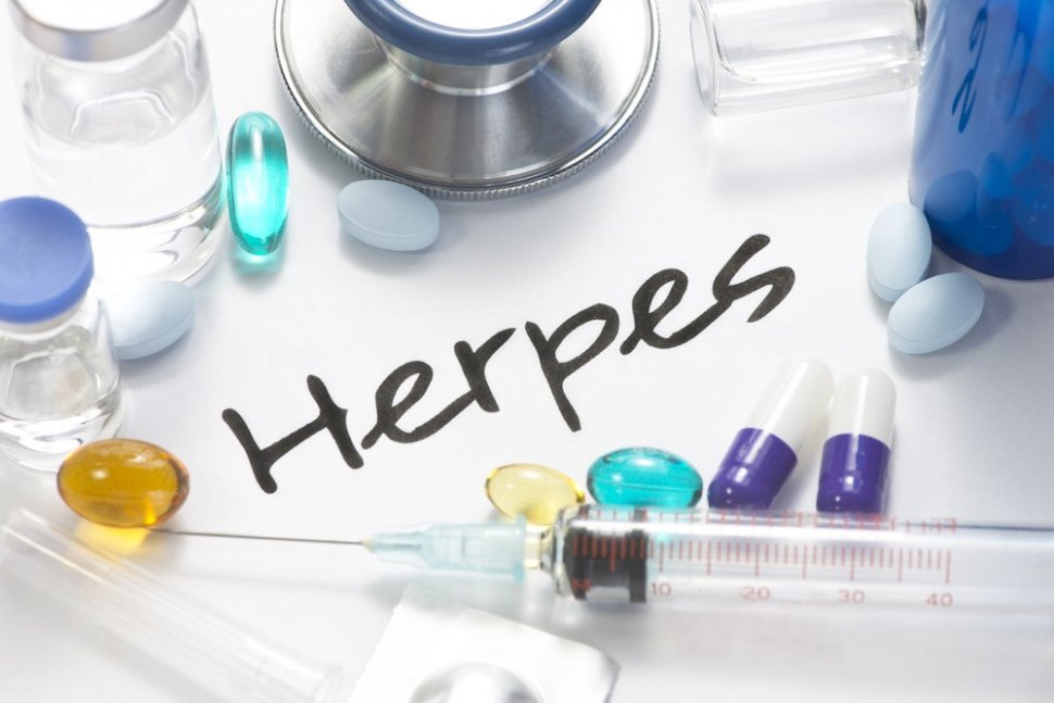 Ilustrasi pengobatan penyakit herpes. (Shutterstock)