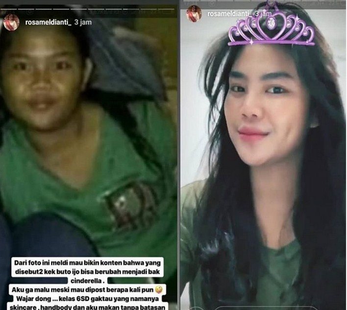 Rosa Meldianti dengan foto masa kecilnya yang disebut gendut dan buluk. [Instagram]