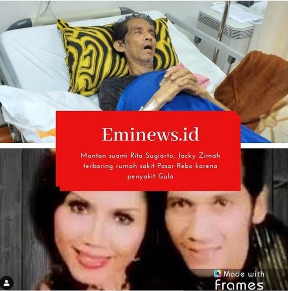 Jacky Zimah saat dirawat di rumah sakit. [Instagram Eminews]