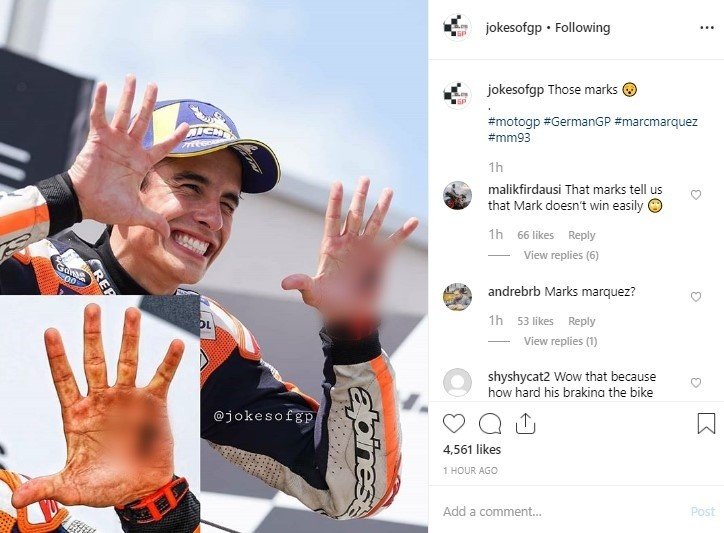 Luka di Tangan Marc Marquez. (Instagram/jokesofgp)