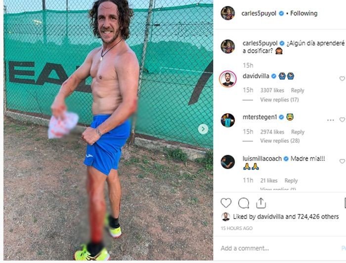 Carles Puyol terluka saat bermain tenis lapangan. (Instagram/@carles5puyol).