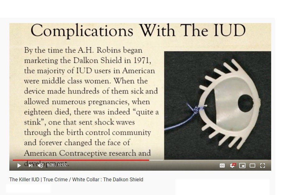 IUD pertama, Dalkon Shield (YouTube/Brittney Guadalupe)