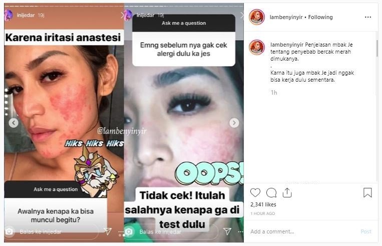 Wajah Jessica Iskandar rusak. (Instagram/@lambenyinyir)