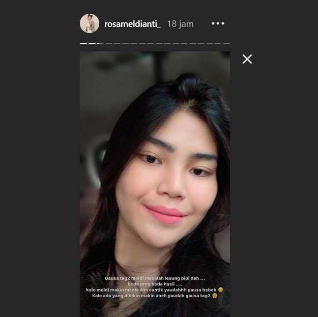 Rosa Meldianti curhat tak terima lesung pipitnya disamakan dengan Barbie Kumalasari. [Instagram]