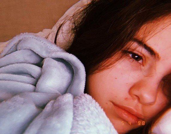 Wajah bareface Selena Gomez. (Instagram/@selenagomez)