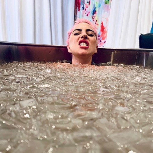 Lady Gaga. (Instagram/@ladygaga)