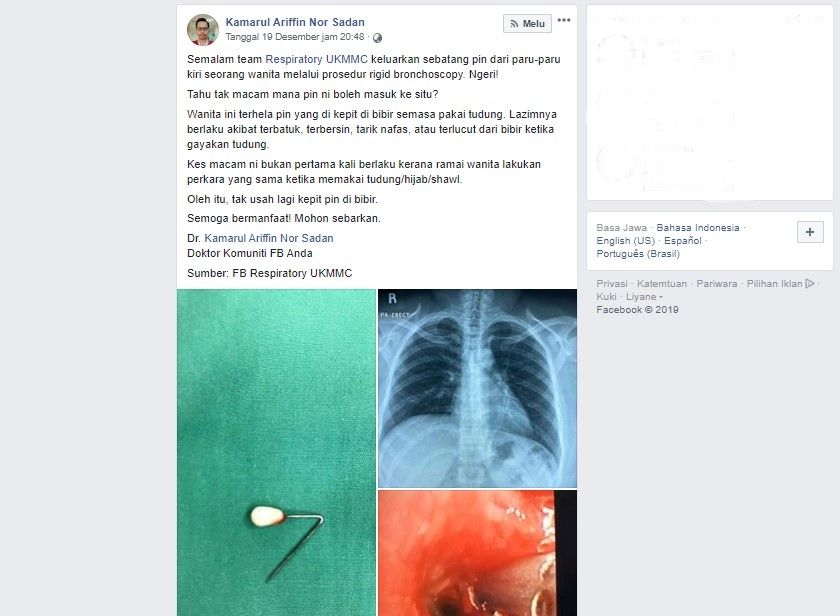 Peniti di dalam paru-paru seorang perempuan (Facebook/Kamarul Ariffin Nor Sadan)
