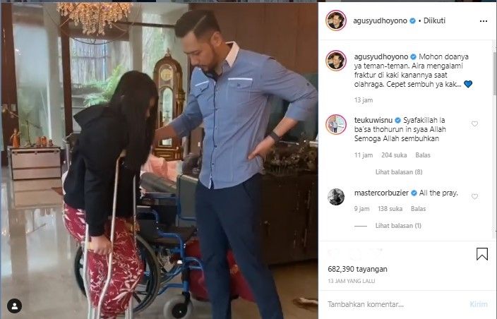 Aira Yudhoyono mengalami fraktur tulang di kaki kanannya (Instagram/AgusYudhoyonoAC)