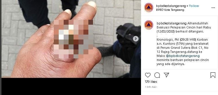 Pria pakai cincin kekecilan sampai jari bengkak. (Instagram/@bpbdkotatangerang)