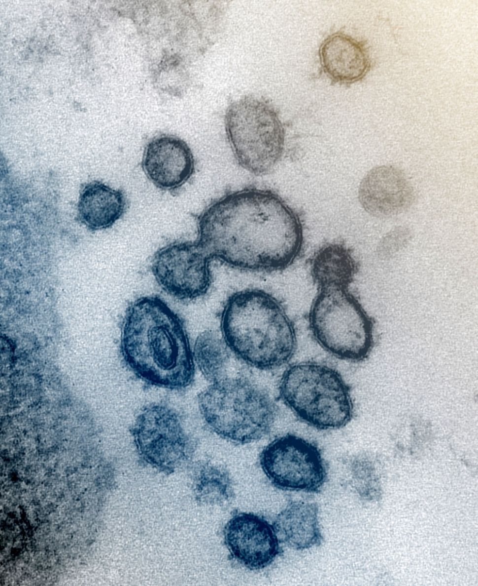 Penampakan virus corona baru (COVID-19), credit: NIAID-RML