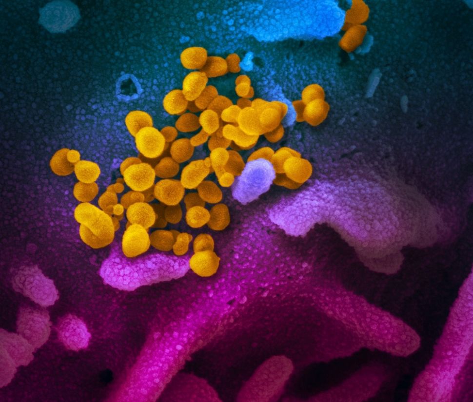 COVID-19 (kuning) di antara sel-sel manusia (biru, merah muda dan ungu), credit: NIAID-RML