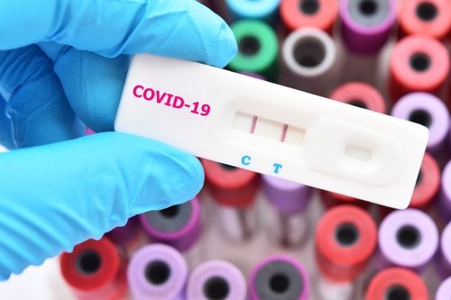 Ilustrasi rapid test virus Corona Covid-19. (Shutterstock)