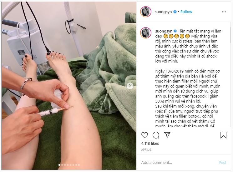 Selebgram Vietnam Suntik Botox Akibat Digigit Nyamuk (instagram.com/suongsyn)