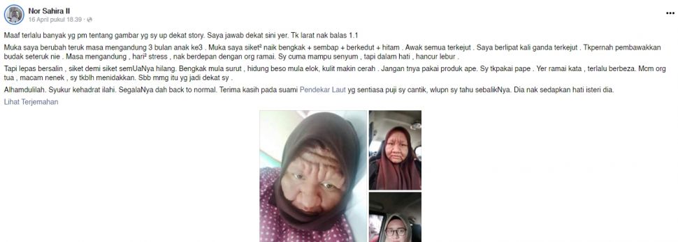 Perempuan hamil seperti nenek-nenek. (Dok: Facebook/Nor Sahira II)