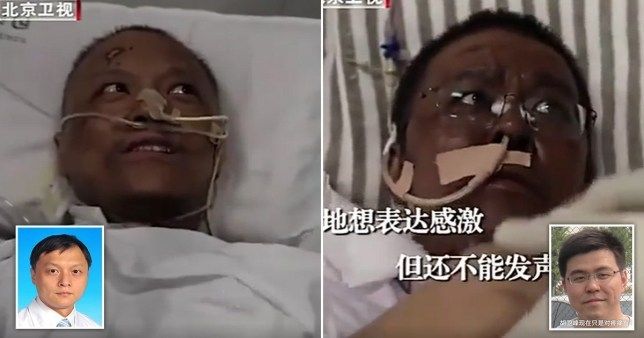 Kulit dokter berubah warna akibat covid. (dok: CCTV)