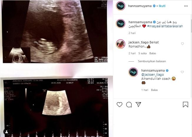 Hansamu Yama umumkan kehamilan sang istri, Zerlinda Gitta. (Instagram/@hannsamuyama).