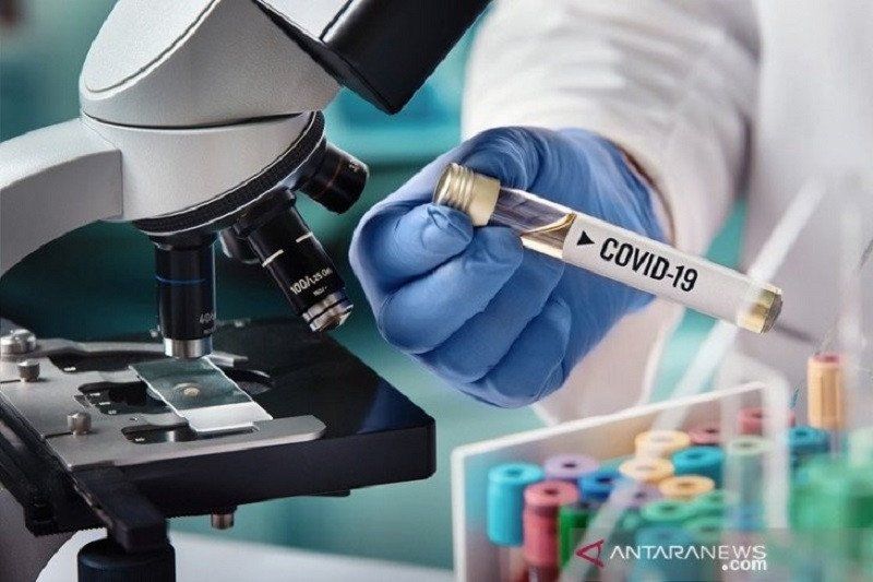 Peneliti berupaya menciptakan vaksin virus corona. (ANTARA/Shutterstock/am.)