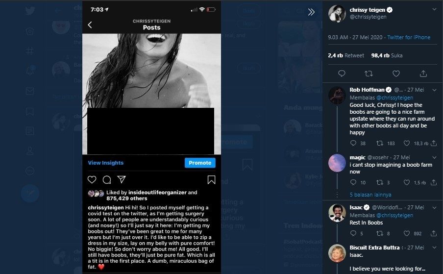 Unggahan Chrissy Teigen bahwa ia akan operasi (Twitter/Chrussy Teigen)