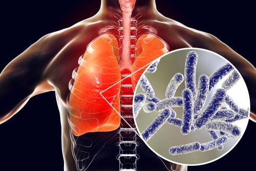 Ilustrasi: Legionnaires (Shutterstock)