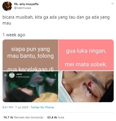 Kecelakaan, gadis ini justru donorkan kornea matanya (Twitter).