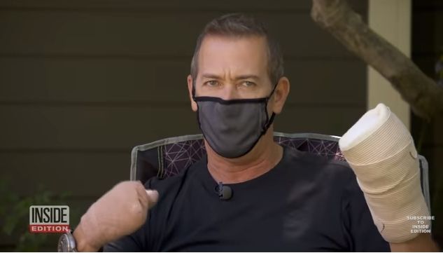 Gregg Garfield kehilangan jari karena Covid-19. (YouTube/Inside Edition)