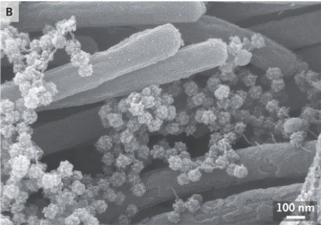 Penampakan SARS-CoV-2 di saluran pernapasan (New England Journal of Medicine)