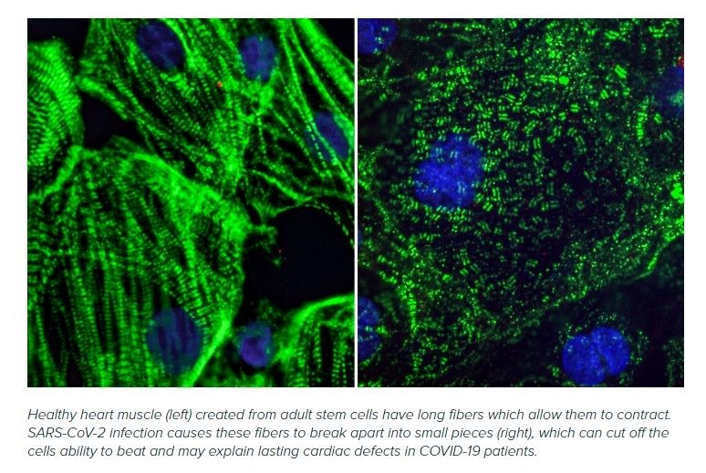 Penampakan studi virus corona memengaruhi sel otot jantung (gladstone.org/Gladstone Institute)