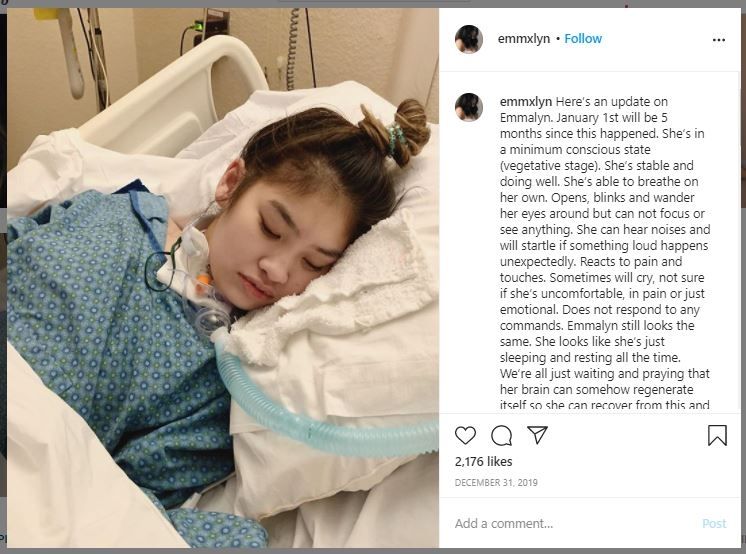 Koma 14 Bulan, Remaja Ini Meninggal karena Implan Payudara (instagram.com/emmxlyn)
