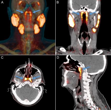 Dokter temukan organ baru. (Matthijs H.Valstarab et al.)