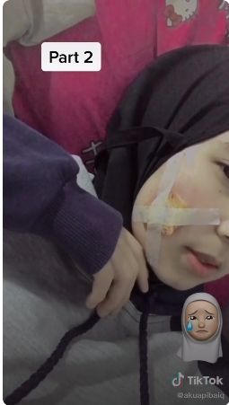 Tangkapan Layar Video Viral Wanita Infeksi Gegara Pakai Masker Kain Pas Jerawatan (TikTok/@akuapibaiq)