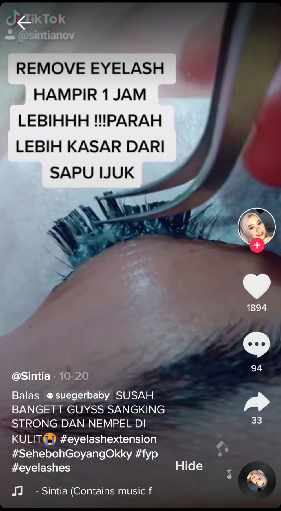 Bulu mata kaku seperti sapu ijuk. (TikTok/Sintianov)