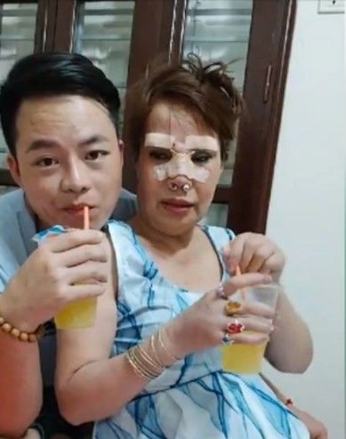 Nenek 62 Tahun Rela Operasi Plastik Agar Lebih Cantik. (Dok: kenh14.vn)