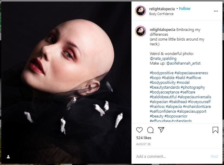 16 Tahun pakai Wig, Model Ini Akhirnya Mengaku Botak (instagram.com/relightalopecia)