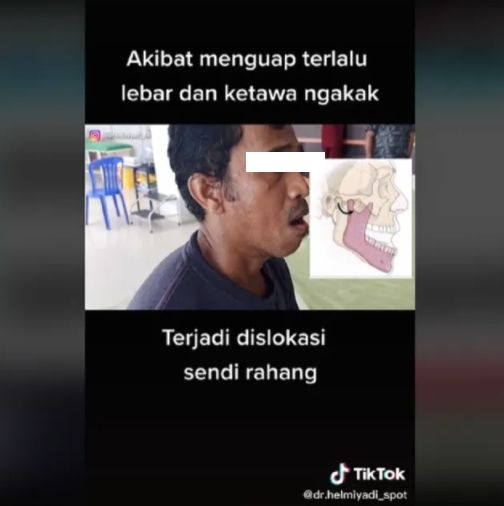 Video kondisi pria yang alami dislokasi sendi rahang. (TikTok/@dr.helmiyadi_spot)