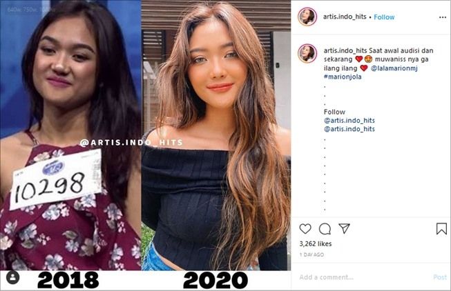 Marion Jola Viral Indonesia Idol Image Telegraph 