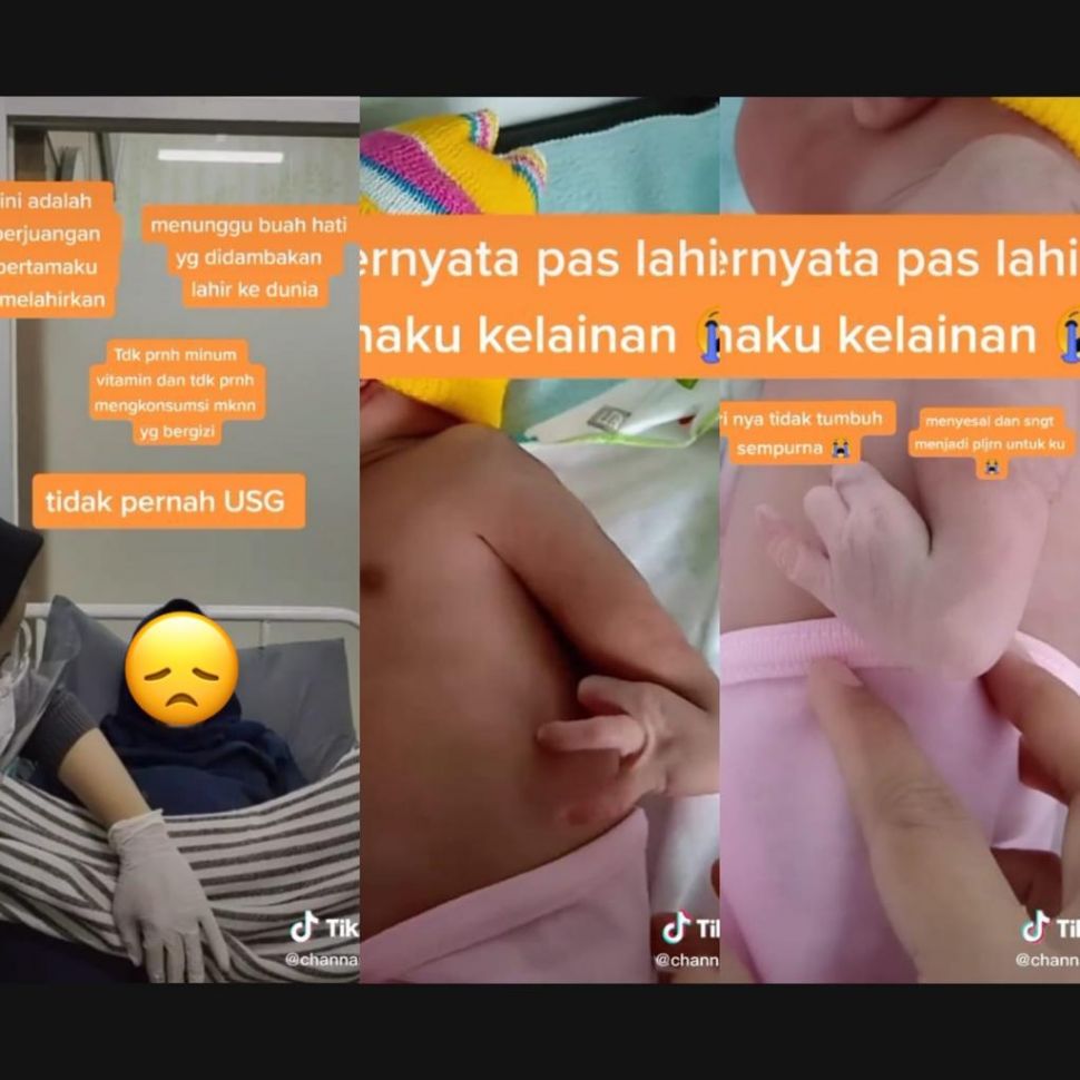 Konten Viral: Ibu Hamil Tak Pernah USG dan Minum Vitamin, Bayi Lahir Begini (TikTok/)