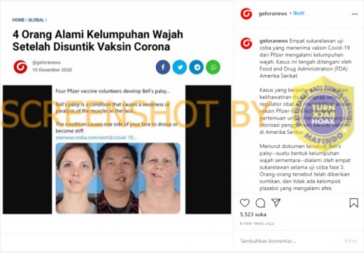 Cek Fakta Foto Orang Lumpuh Wajah Usai Suntik Virus Corona (Turnbackhoax.id).