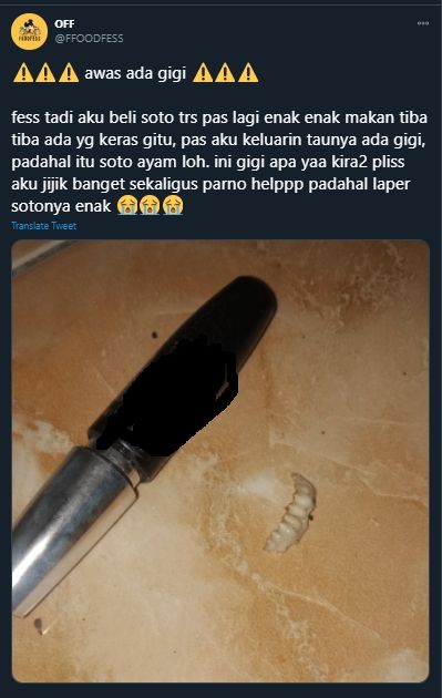 Ngeri-ngeri Sedap, Orang Ini Temukan Gigi Misterius saat Makan Soto. (Twitter/@FFOODFESS)